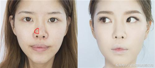 脸长嘴凸怎么办,鼻头大鼻翼宽怎么化妆改善