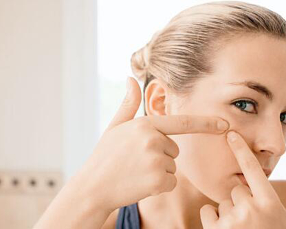 脸颊两侧长痘用什么药膏,脸颊两侧长痘中医怎么说