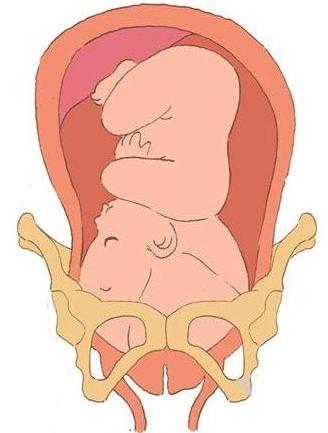 39周入盆特征,孕妇后期入盆的特征