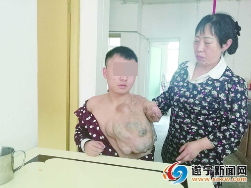 坚强母亲18年不离不弃带着患病儿子艰难求医