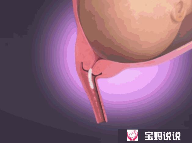 涨姿势！分娩过程原来是这样的