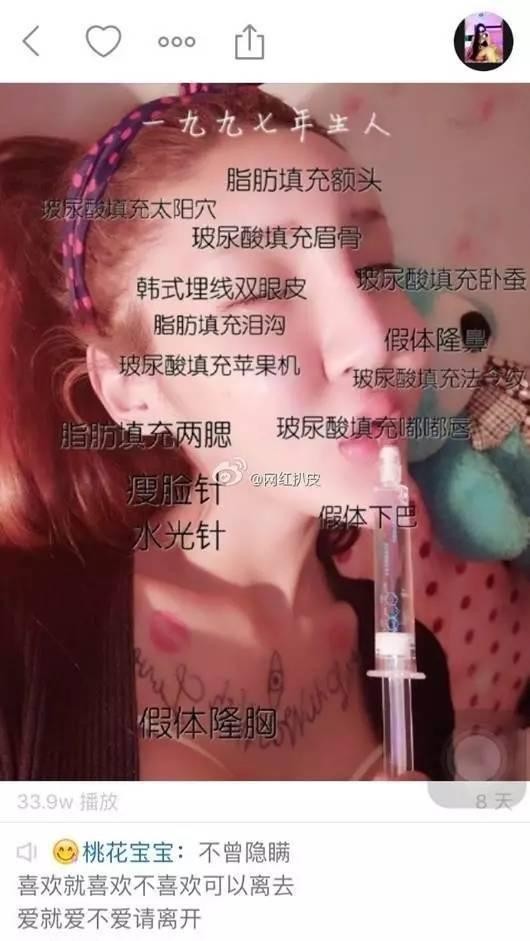 一眼就秒杀刘梓晨的“鱼精女”，看她整容后的脸感觉今晚会做噩梦