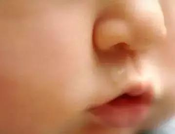 清水鼻涕黄痰鼻塞是风寒还是风热,小孩流黄鼻涕是风寒还是风热