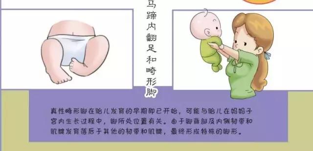 宝宝穿扶站鞋有必要吗,十个月宝宝会扶站需要买鞋吗