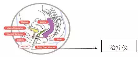 怀孕分娩时承受多少痛苦,怀孕分娩引起的肾功能损伤