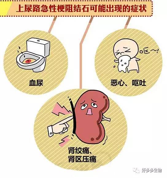 肾积水引发的尿漏怎么办,肾积水排尿困难吃什么药