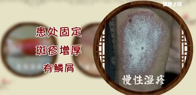 健康之路中医治痛有妙招,健康之路小经方大智慧