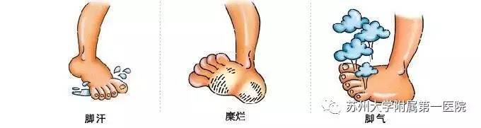 每天汗如雨下好不好,每天都汗如雨下