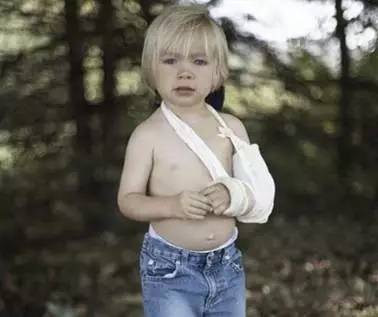 宝宝摔倒磕到头肿起来软软的,宝宝摔倒磕到后脑勺观察多久