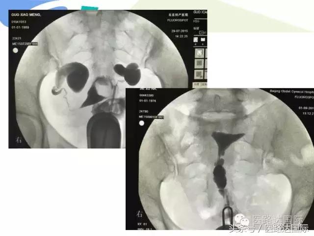 北京妇产医院梁宇霆,北京妇产医院梁宇霆出诊