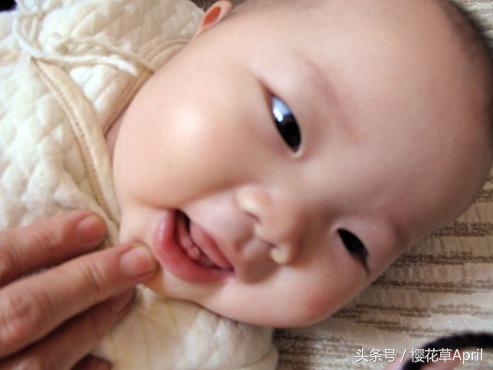 一月黄疸二月肠绞痛三月睡眠倒退,1月黄疸2月肠绞痛3月睡眠倒退