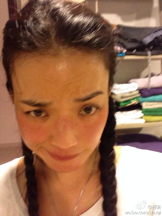 舒淇过敏修复方法,舒淇敏感肌自救方法