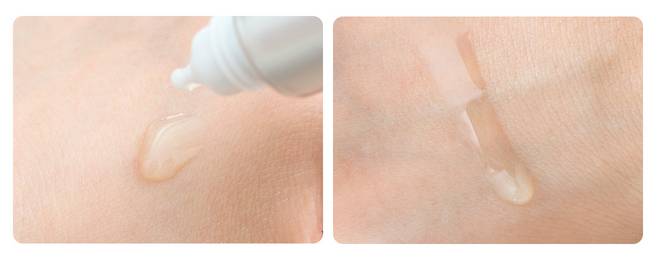 祛痘神器痘痘的克星,和痘痘疯狂抗争的经历