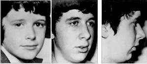 小孩越长越丑什么原因,小孩五官越来越丑的原因