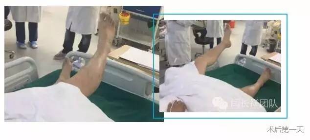 闫长祥脑膜瘤,闫长祥能治愈弥漫中线胶质瘤吗