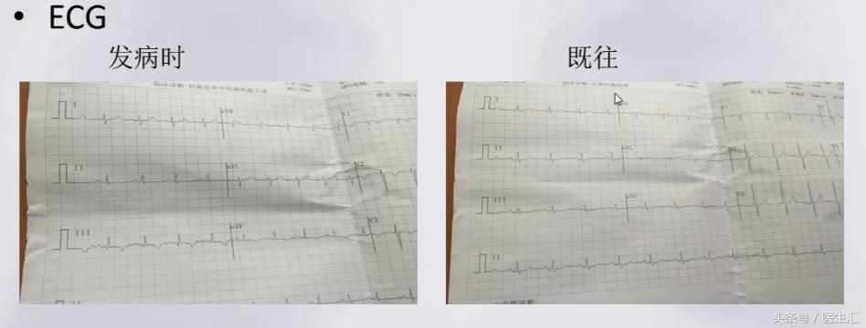 院方回应孕妇等2小时后流产,院方回应孕妇医院等2小时后流产