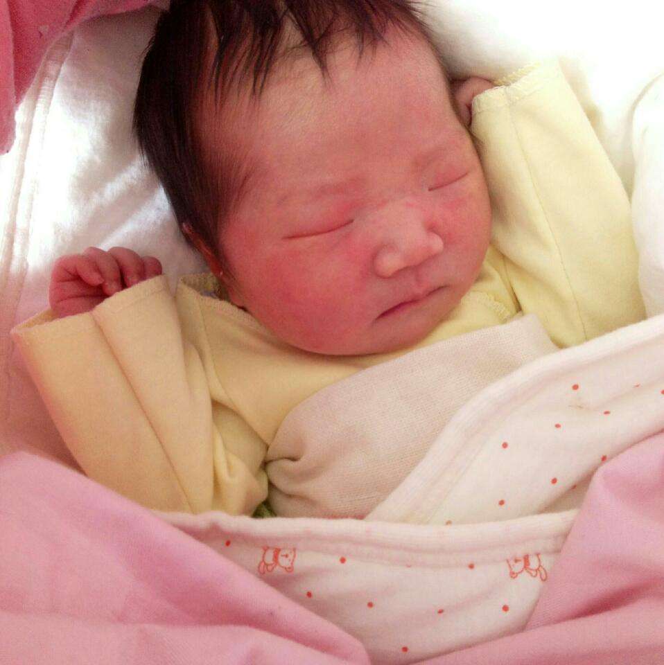 宝宝患上鹅口疮是怎么回事？妈妈正确的做法