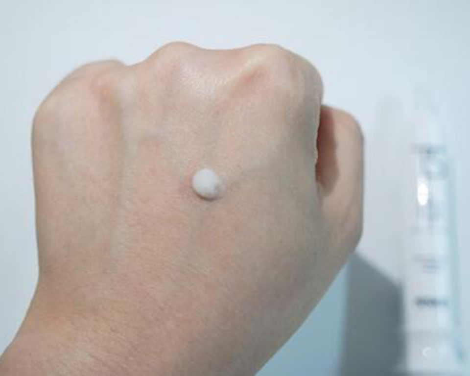 脸上长痘痘怎么快速消除,脸上的痘痘变成疮怎么办