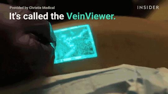 这个黑科技能照亮你的血管，让护士好好地给你扎针！