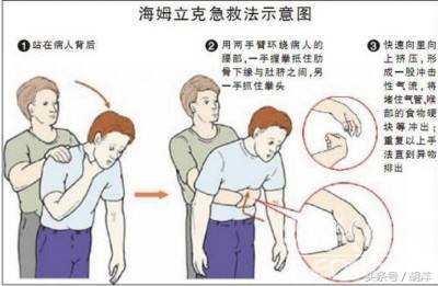 异物呛入气管的急救,呛到气管里异物急救法