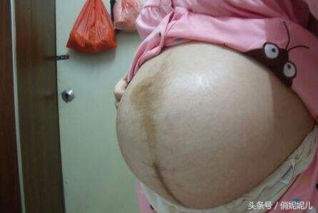 宝宝入盆的途中有什么反应,宝宝入盆了有什么感觉吗