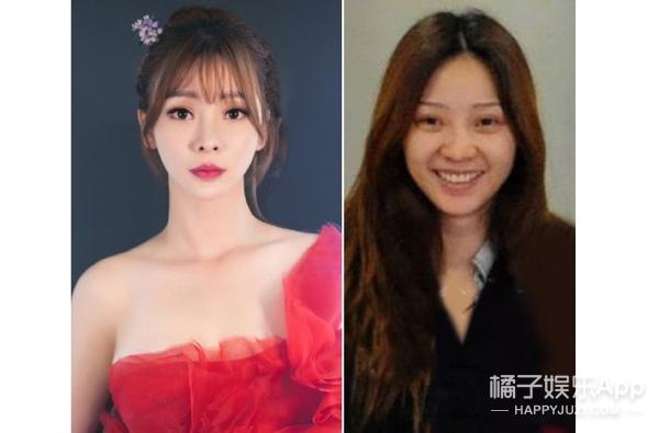 笑容引起的法令纹怎么解决,明星淡化法令纹最简单方法