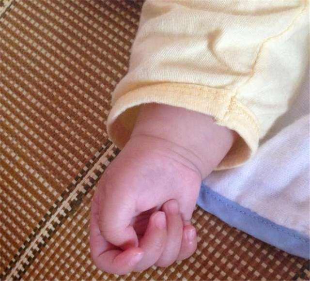 宝宝一个月拇指内扣是脑瘫嘛,宝宝拇指内扣是不是大脑受损