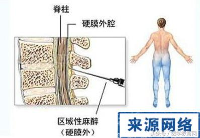 剖腹产女性手术,女的剖腹产手术的全部流程