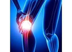 冬病夏治一招治膝盖疼痛,冬病夏治颈肩腰腿痛的好处