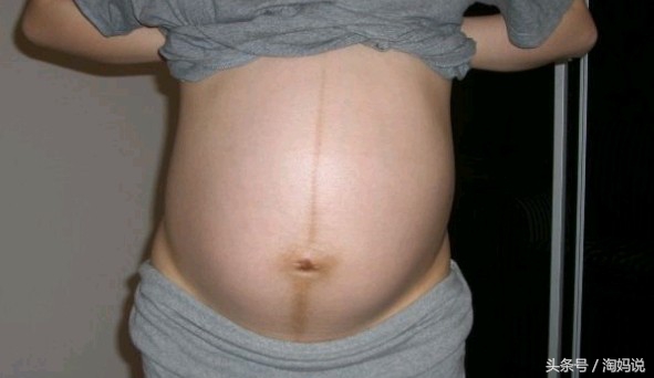 胎宝宝总是踢膀胱是怎么回事,胎宝宝踢妈妈膀胱会尿急么