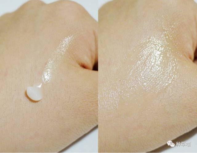 盘点最好用的祛痘神器,祛痘神器2-3天快速祛痘不留印