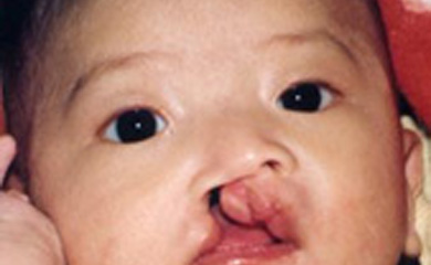 容易造成胎宝宝畸形的行为,造成宝宝畸形的隐形杀手