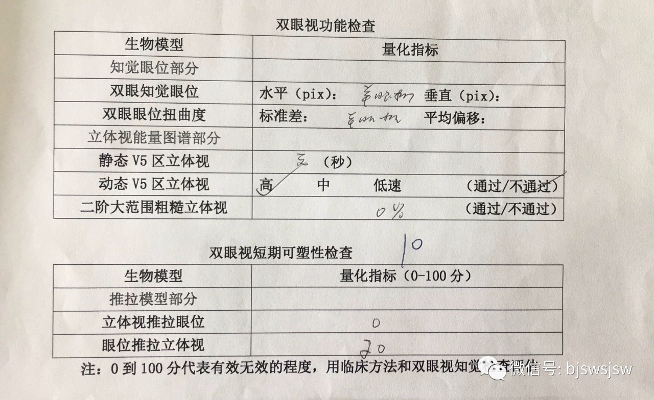 儿童弱视缺乏立体视觉,单眼弱视怎样训练双眼立体感呢