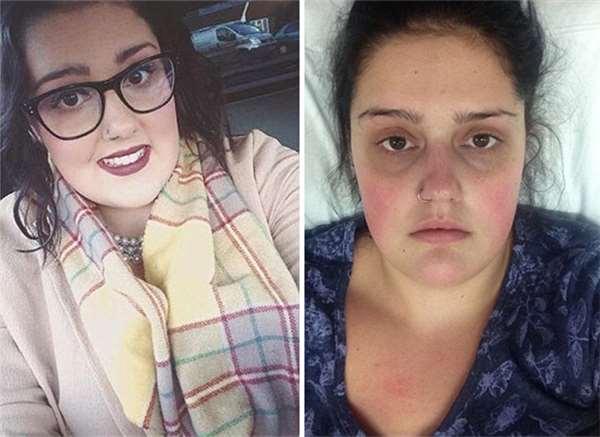 粗心的她把棉条忘在体内9天，取出时颜色竟呈现黑色差点让她丧命