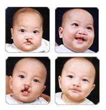 世界爱耳日在线观看,世界爱耳日主题