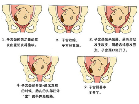 第70课：如何催产