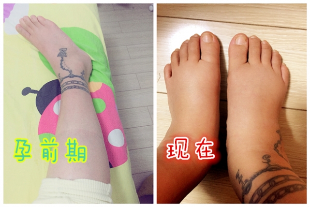 第一次孕检遇到哪些尴尬,第一次医院孕检避免被坑