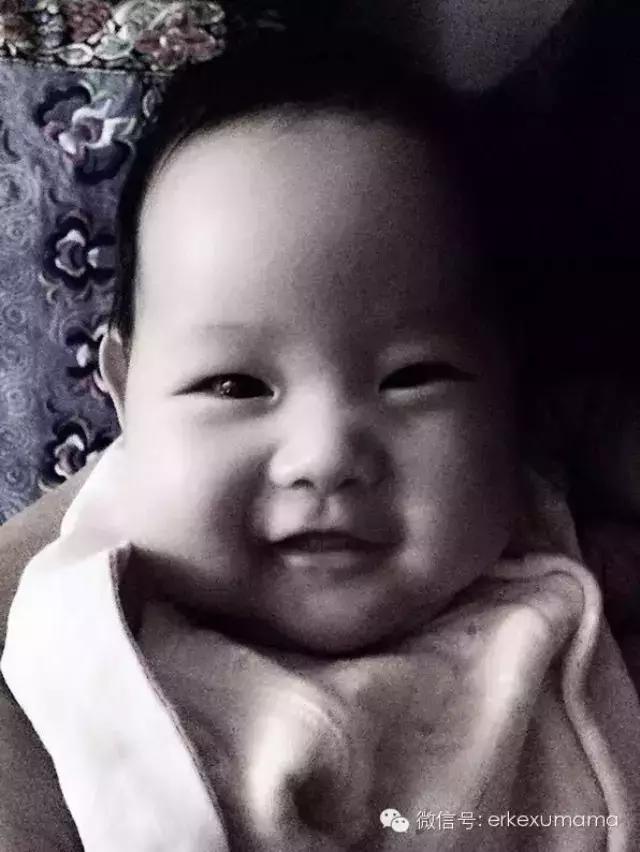 怎么分辨是黄疸还是皮肤黄 (怎么判断皮肤黄是黄疸)