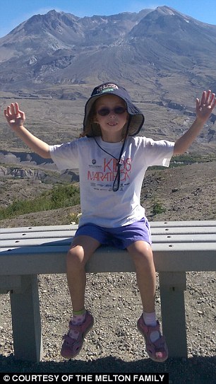 没有下巴的女孩长什么样子,一出生就没有胳膊的女孩