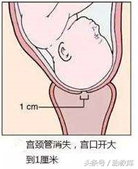 宫口从一指开到10指要多久,宫口从1指开到2指用了24小时