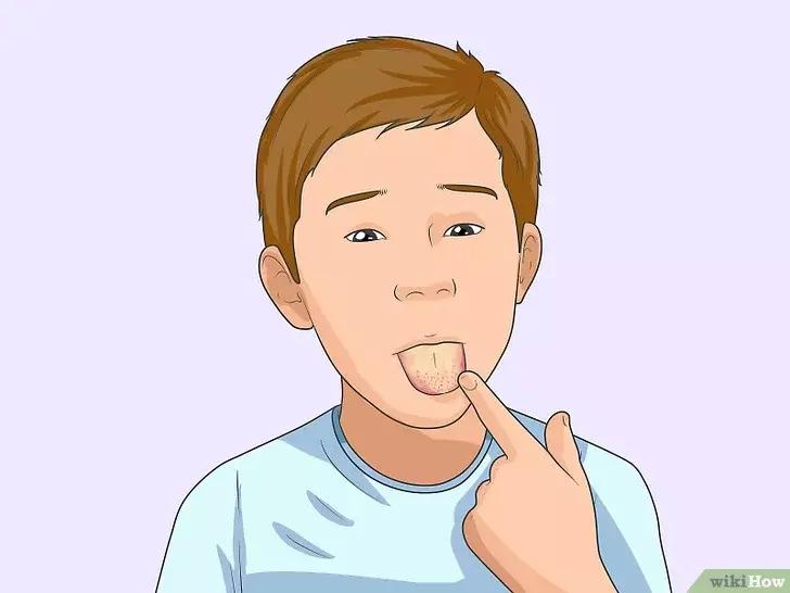 如何判断咽喉炎是不是细菌性感染,抗链球菌高引起的咽喉炎怎么治疗