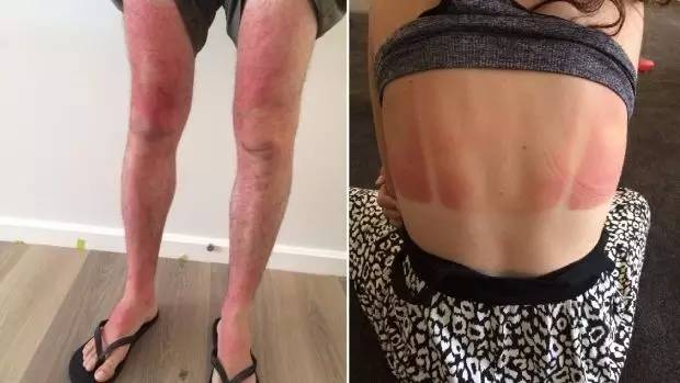 还在给宝宝海淘香蕉船防晒霜?出事了!家里有的快扔掉!