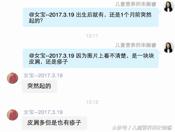 宝宝起头皮屑怎么处理,2个月宝宝皮屑太多了怎么回事