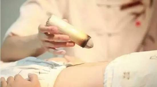 宝宝艾灸的禁忌,儿童艾灸怎么避免烫伤