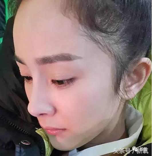 杨幂发际线还会回归吗,杨幂发际线秃到后脑勺