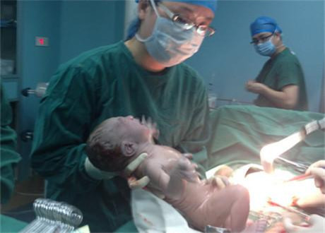 预产期前一个星期剖腹产,预产期没到没反应医生让剖腹产