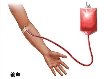 儿童再障发病率,再障儿童有什么病理现象