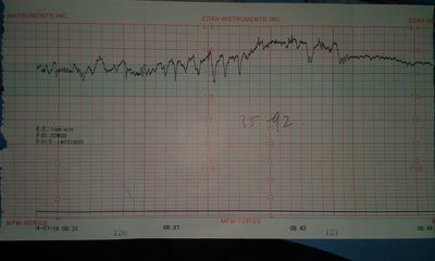准妈妈必看孕期运动注意事项,孕期1-40周检查表明细表