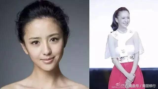 掉头发严重防脱洗发水有用吗,掉头发用防脱的洗发水有效果吗