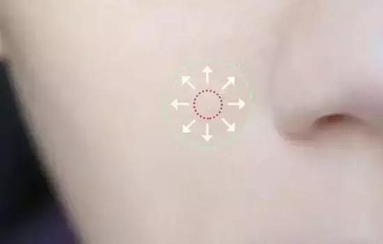 黑眼圈有痘痘怎么治,女人有黑眼圈